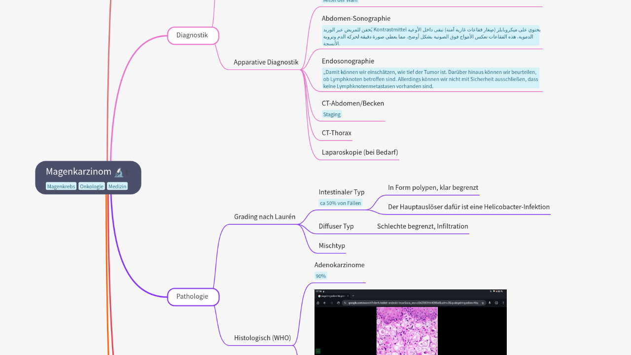Mind Map:Magenkarzinom ...