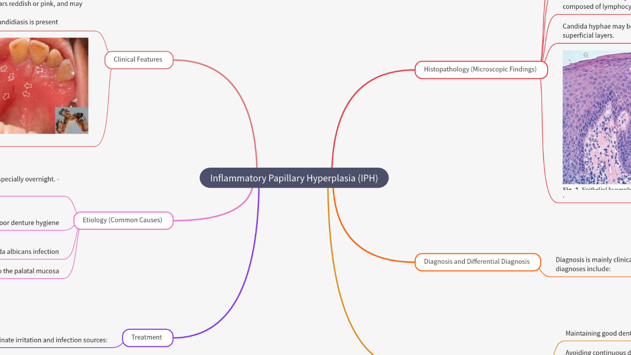 Mind Map:Inflammatory Papillary Hyperplasia (IPH) ...